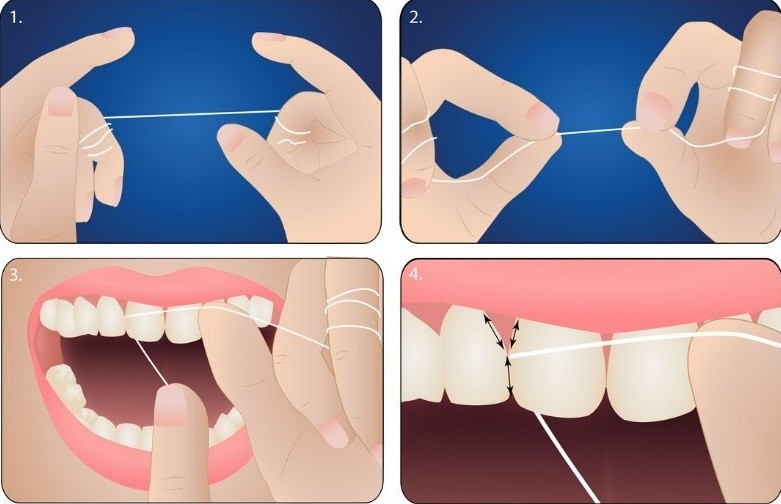 Những thói quen có lợi giúp cho răng luôn trắng sáng