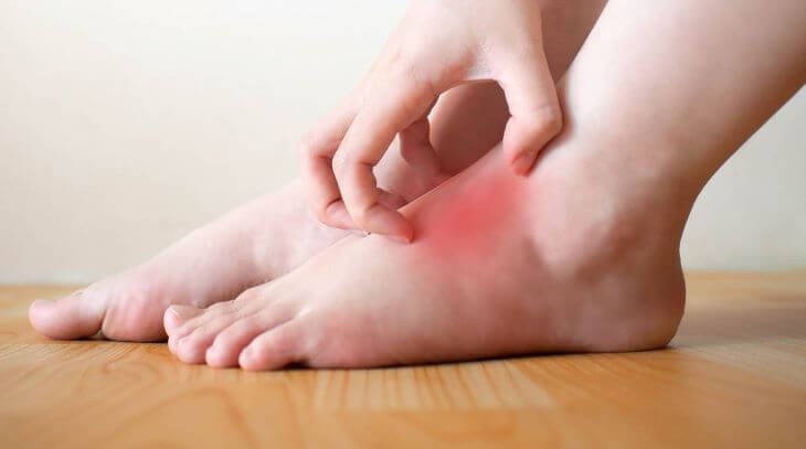 Nếu chân cùng lúc xuất hiện 3 dấu hiệu này, đi khám ngay kẻo hối không kịp