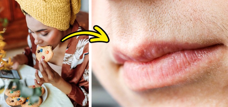 6 cách ngăn chặn sự phát triển của lông trên khuôn mặt