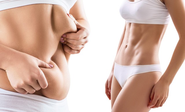 Thẩm mỹ viện du ký: Hút mỡ thẩm mỹ, sự thật và ngộ nhận