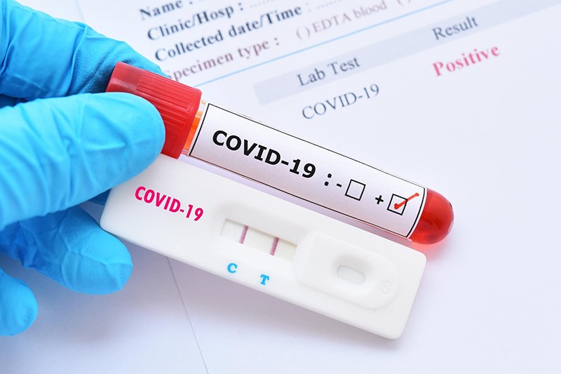 Những đối tượng nào cần xét nghiệm Covid-19 khi đến các cơ sở y tế ở TPHCM?