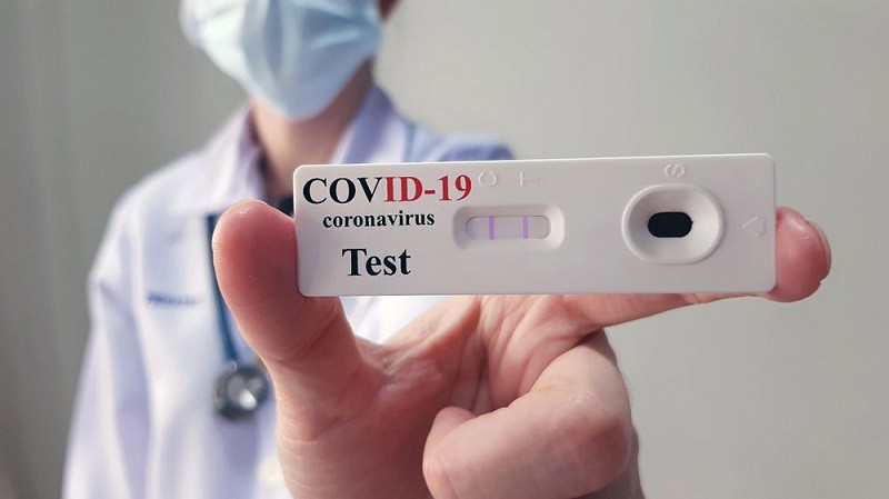 Sở Y tế TPHCM niêm yết công khai giá xét nghiệm Covid-19 tại các cơ sở y tế