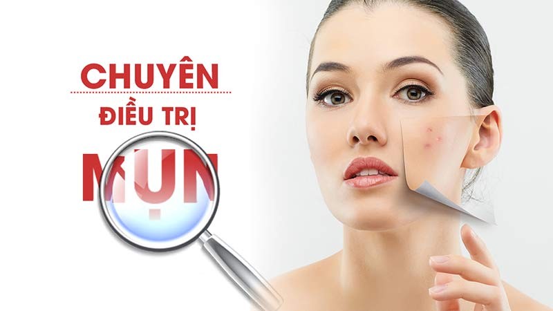 Hiểu được nguyên nhân gây mụn để chăm sóc da mụn hiệu quả