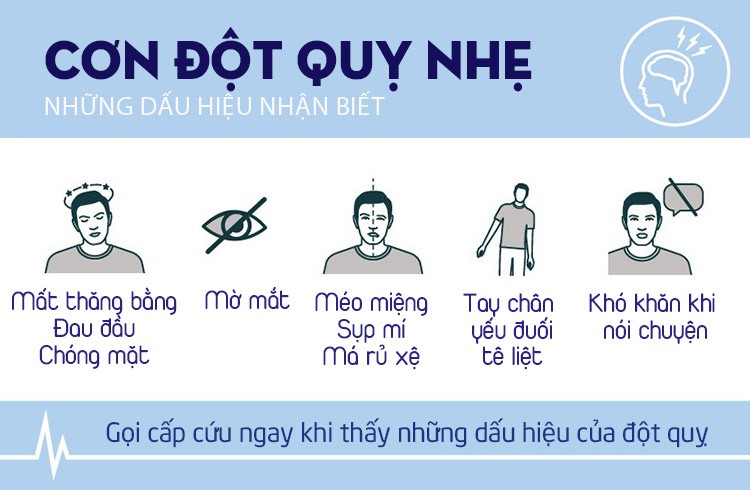 5 dấu hiệu cảnh báo cơn 'đột quỵ nhẹ'