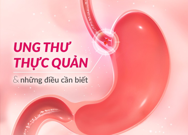 Nguy cơ gây ung thư thực quản vì thói quen ăn uống đồ quá nóng