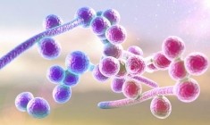Nhận biết nấm Candida sinh dục