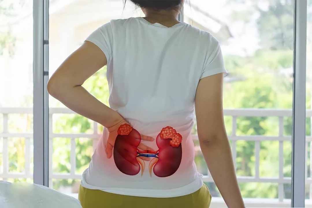 10 dấu hiệu cho thấy bạn đang mắc bệnh thận