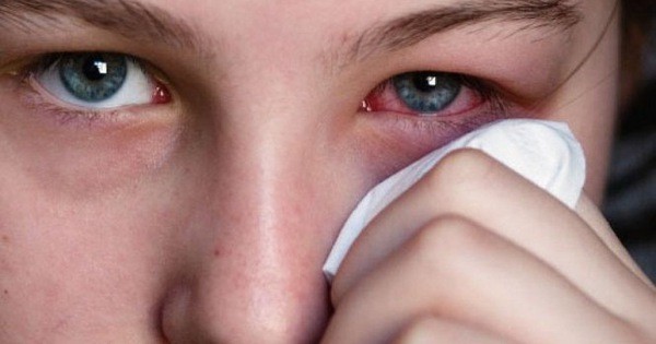Bệnh viêm củng mạc ảnh hưởng gì đến sức khỏe chúng ta?