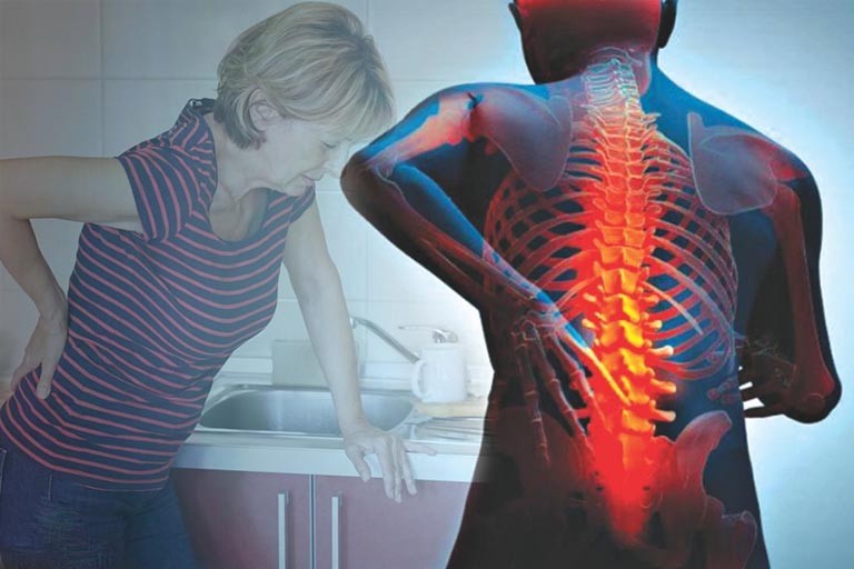 Những triệu chứng dễ thấy nhất của bệnh thoái hóa cột sống ở người trung niên