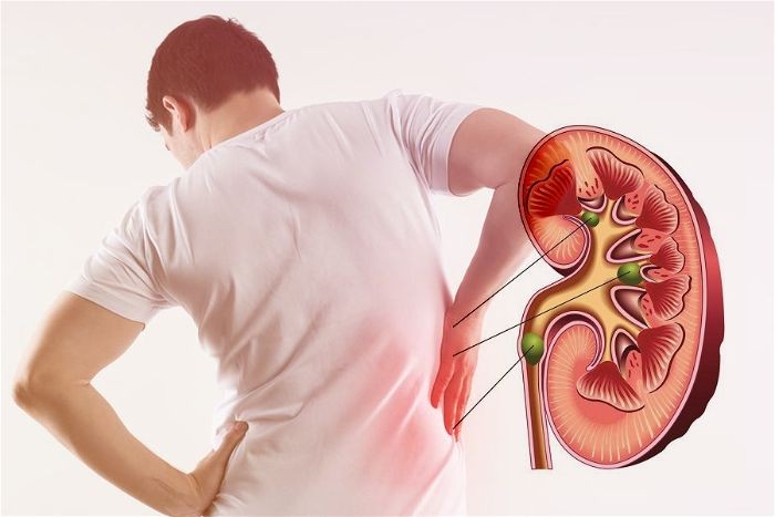 Thận không còn hoạt động sẽ ảnh hưởng đến quá trình lọc máu của cơ thể!