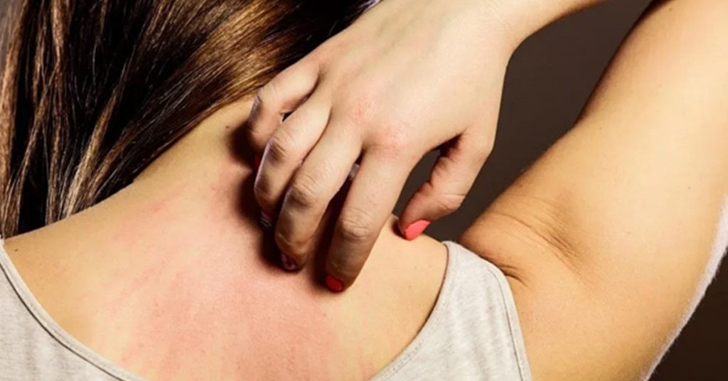 Da bất thường là dấu hiệu nguy hiểm của bệnh ung thư tuyến tụy