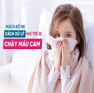 Cách xử lý chảy máu cam ở trẻ em mà cha mẹ cần biết