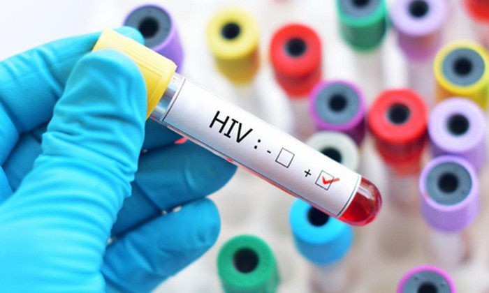 Người đầu tiên nhiễm HIV ở Việt Nam vẫn sống khoẻ mạnh sau 30 năm