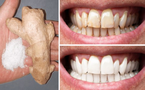 8 cách đơn giản giúp bạn sở hữu hàm răng trắng tinh thu hút mọi ánh nhìn mà không cần đến nha sĩ