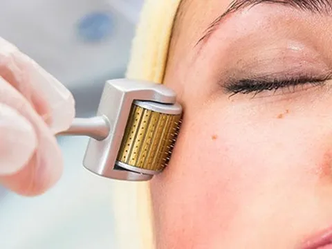 Những sai lầm khi lựa chọn lăn kim làm đẹp