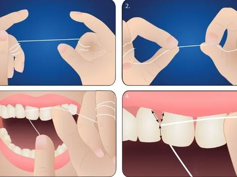 Những thói quen có lợi giúp cho răng luôn trắng sáng