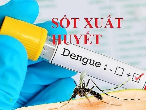 Sốt xuất huyết có nên cạo gió không?