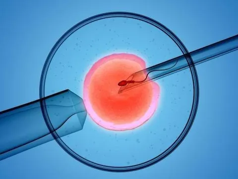 Phụ nữ sử dụng liệu pháp hỗ trợ sinh sản dễ bị biến chứng mạch máu