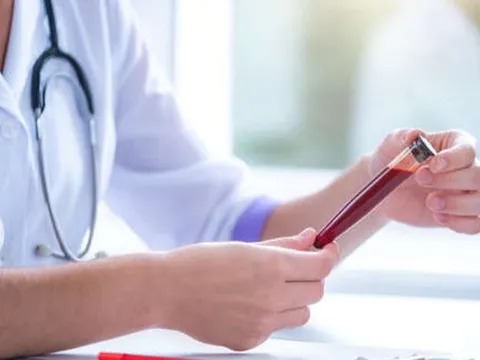 Nếu có nhóm máu này, bạn sẽ dễ bị đông máu hơn