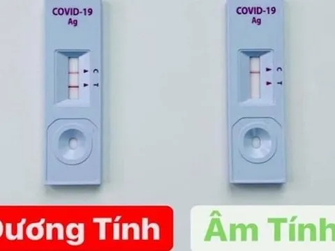 Chuyên gia chỉ rõ sai lầm nghiêm trọng khi sử dụng test nhanh Covid-19 & thuốc điều trị