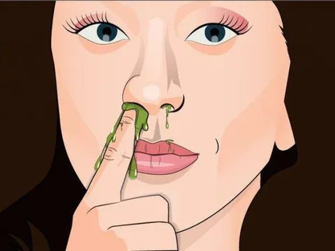 Ngoáy mũi, nhổ lông mũi… là thói quen xấu khiến bạn dễ mắc các bệnh về đường hô hấp