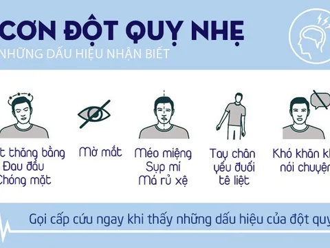 5 dấu hiệu cảnh báo cơn 'đột quỵ nhẹ'