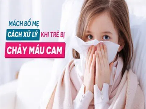 Cách xử lý chảy máu cam ở trẻ em mà cha mẹ cần biết