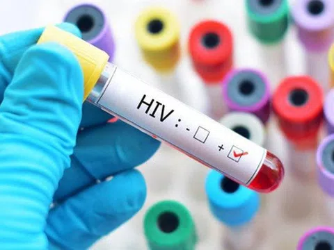 Người đầu tiên nhiễm HIV ở Việt Nam vẫn sống khoẻ mạnh sau 30 năm